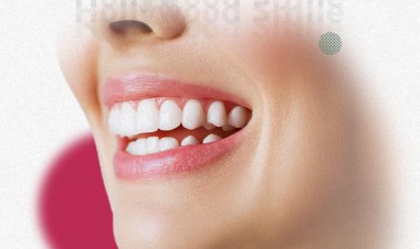 Hollywood smile secrets in Turkey | Do you know the secret of its quality and beauty?