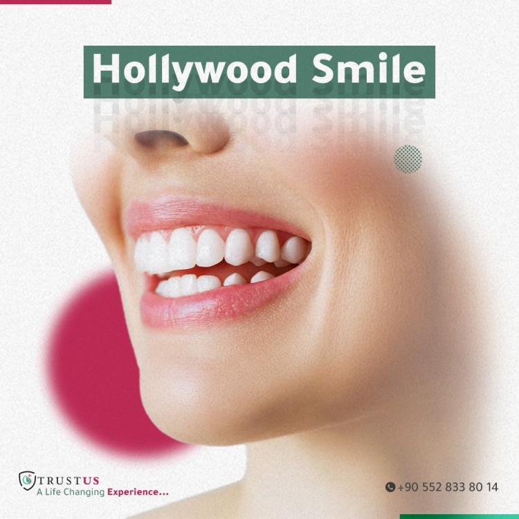 Hollywood smile secrets in Turkey | Do you know the secret of its quality and beauty?